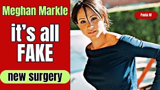 Meghan Markle’s Secret Breast Implants