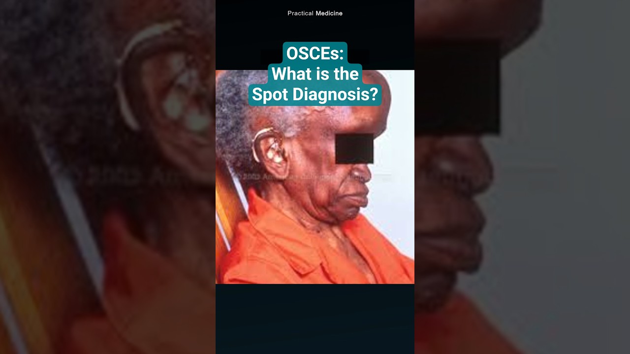 Конкурс экспресс-диагностики #osce #mrcpuk #mrcppaces #spotdiagnosis #bonedisease