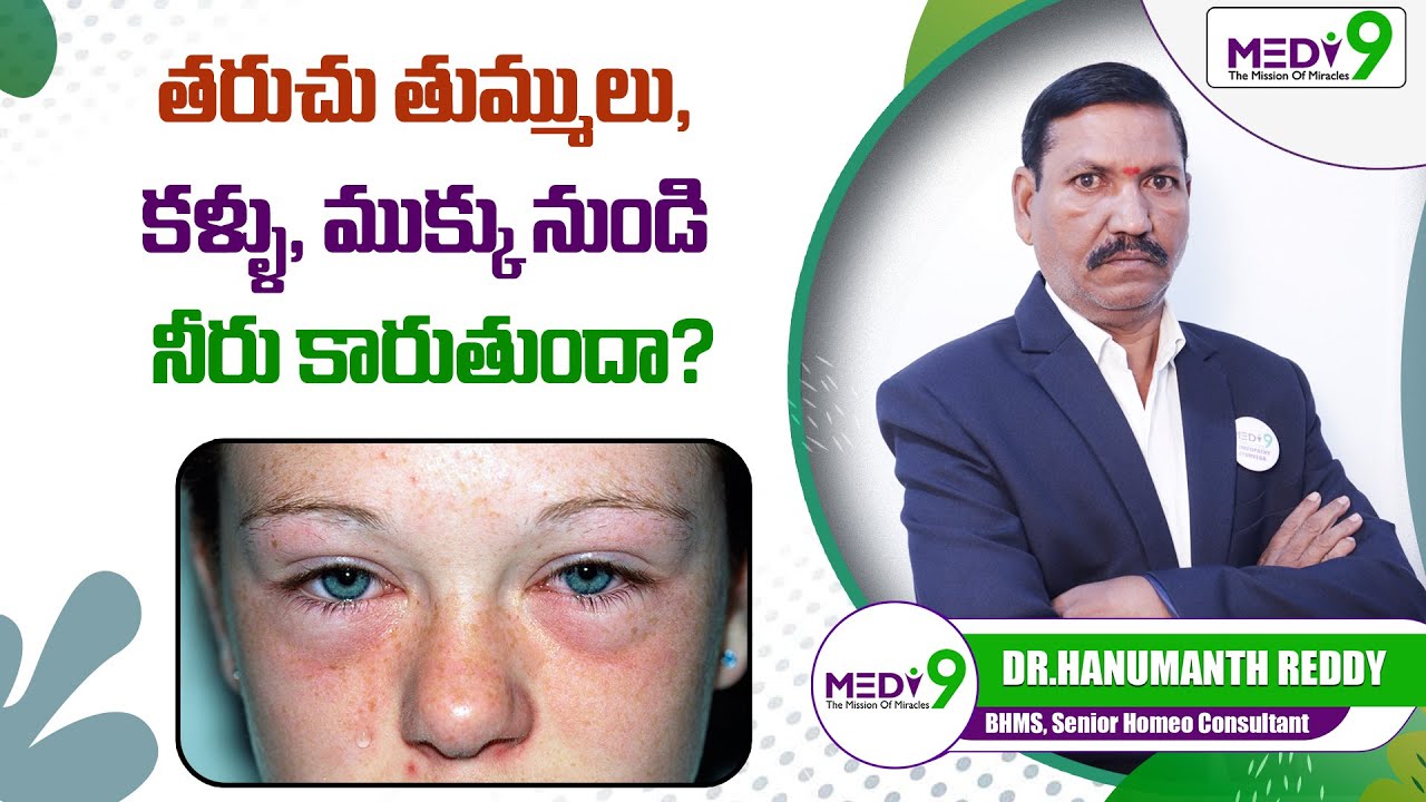 తరుచు తుమ్ములు, కళ్ళు, ముక్కు నుండి నీరు | Allergic Rhinitis Symptoms ...