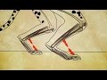 Cheetah Flex Foot and Prosthetics
