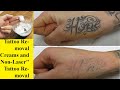 HOW I REMOVE TATTOOS WITH LEMON JUICE AND  BAKING SODA AT HOME !!! { My Experience Lightening }