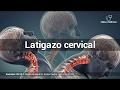 LATIGAZO CERVICAL | DOLOR DE CUELLO (CERVICALGIA) #45