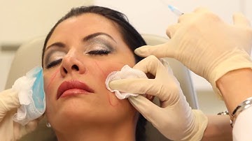 Sculptra Aesthetic | Dermal Filler Injectable | Dr. Carolyn Jacob