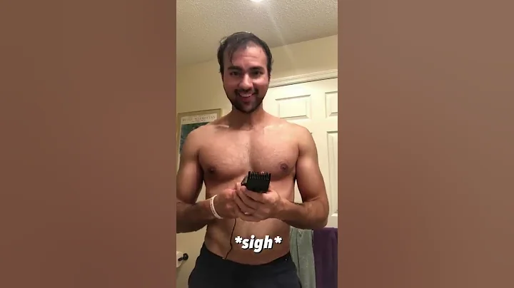 Balding Man Surprised By His New Look