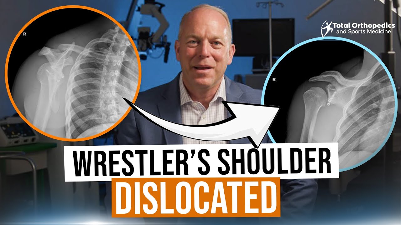 Overcoming Shoulder Dislocations: Shawn’s Wrestling Recovery Story | Orthopedic Surgery Success