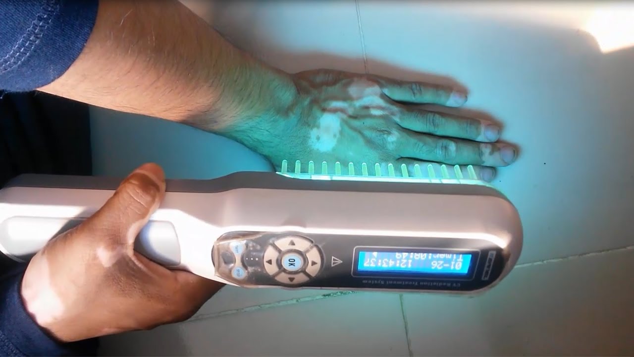 Phototherapy At Home L Narrow Band Uvb Lamps For Vitiligo YouTube Phototherapy At Home L Narrow Band Uvb Lamps For Vitiligo YouTube