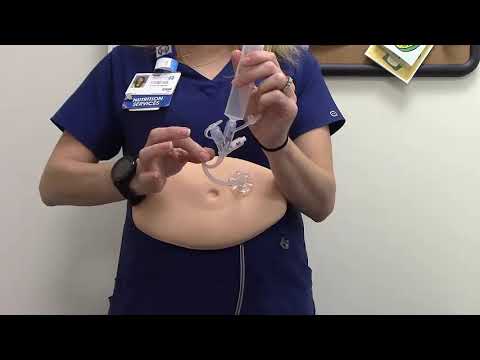 Vídeo: És segur el tub de gastrostomia?