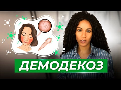 Video: Демодекс бетиңизде жашайбы?