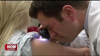 Medical experts share ABCDE warning signs for Skin Cancer detection
