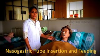 Nasogastric Tube Insertion and Feeding