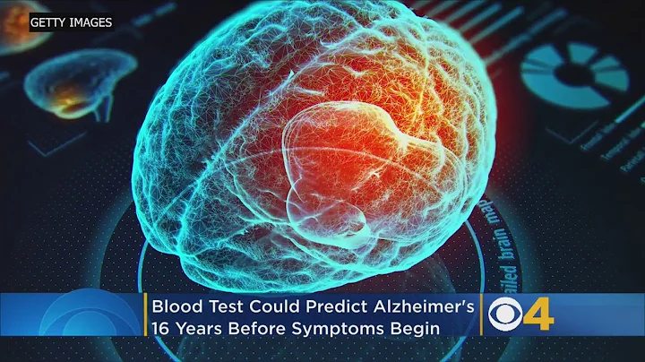 Blood Test Could Detect Alzheimer’s Disease Up To 16 Years Before Symptoms Begin, Study Says