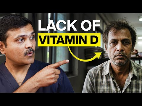 The Vitamin D Deficiency Trap 90 Fall Into