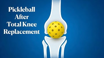 Knee Replacement Won