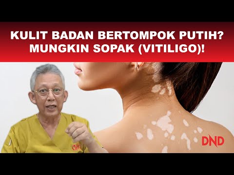 Video: Penyakit Spot Putih: Gejala, Punca, dan Rawatan