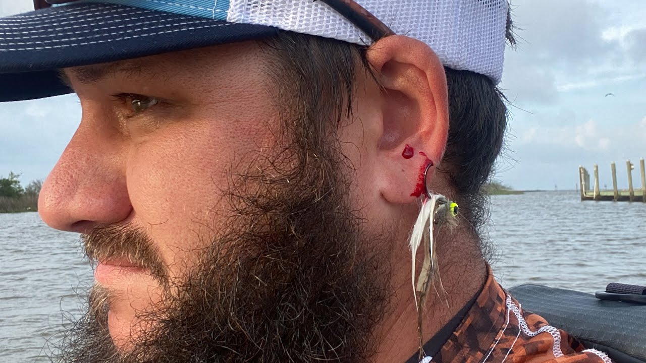 Fisherman Hooked In The EAR!!! (Fishing Fails) YouTube