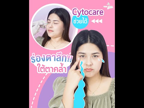 Cytocare แก้ปัญหาร่องตาลึก ใต้ตาคล้ำ