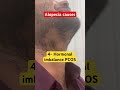 Alopecia causes #haircare #hairlinetransplant