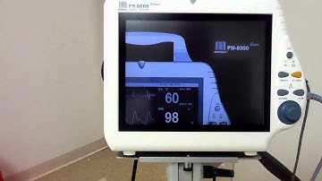 Mindray PM-8000 patient monitor