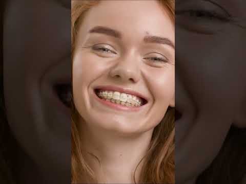 Ceramic vs Metal