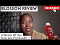 BLOSSOM MAKEUP SKINCARE REVIEW ||2 WEEKS UPDATE||DON'T BUY IF.......