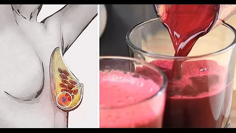 Quais os benefícios do suco da beterraba?