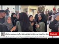 عظامها بارزة من سوء التغذية مأساة طفلة من غزة مصابة بمرض وراثي نادر