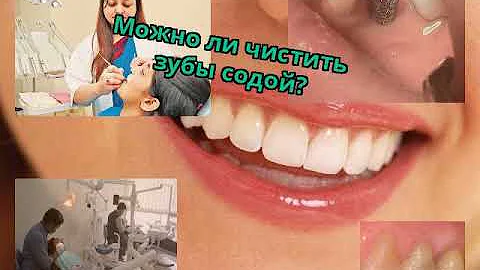 Можно ли чистить зубы содой?