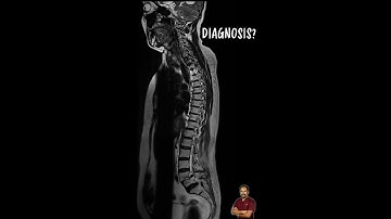 #SpotTheDiagnosis - MRI whole spine