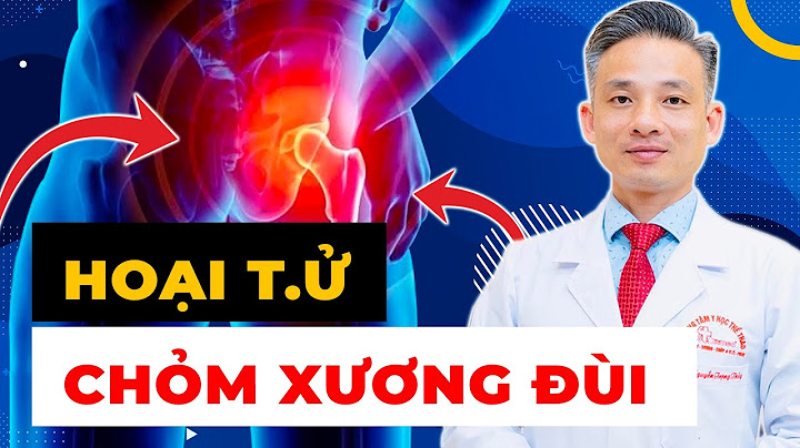 Chỏm xương trụ còn gọi là gì năm 2024