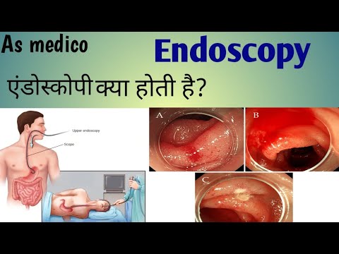 Video Endoscopy Kya Hoti Hai