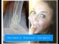 HWR Questions - Hardware Removal - getting the screws out of my ankle. Common Questions