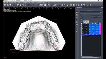 01 Model load and automatic analysis