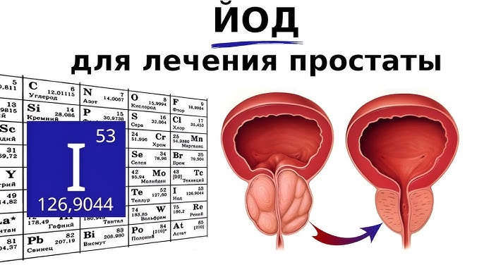 Простата оргазмы YouTube