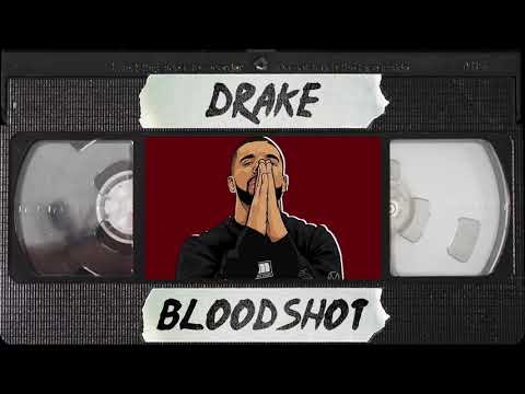 Drake - Bloodshot (ft. French Montana) || Type Beat 2018