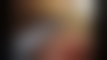 ROBOTIC LOW ANTERIOR RESECTION