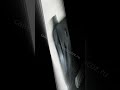 ремонт вентилятора системы охлаждения автомобиля JEEP COMPASS 2 2016