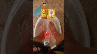 DOES APPLE CIDER VINEGAR AND BAKING SODA SOAKS REALLY WORK?
