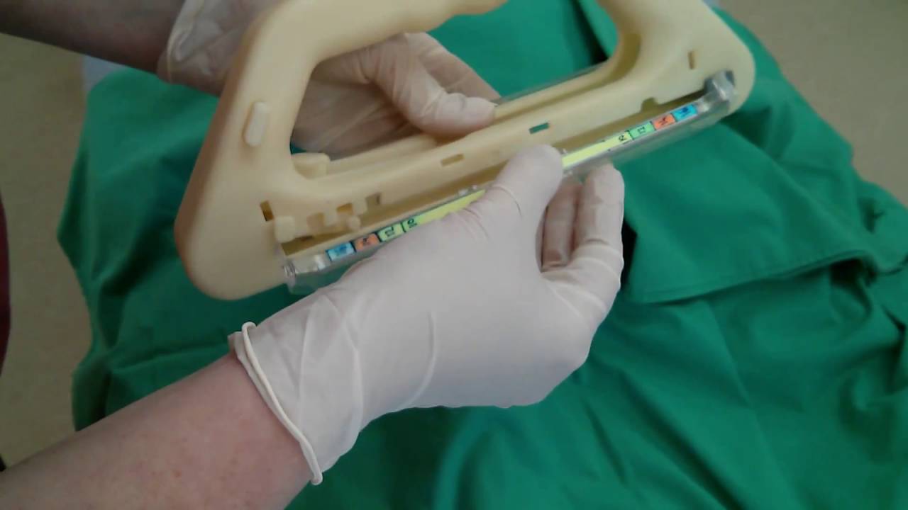 T-Cut prototype for Cesarian Surgery - YouTube