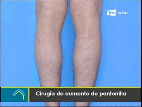 Estética al Día: Cirugía de aumento de pantorrilla