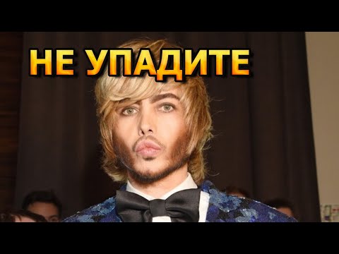 ТЫ НЕ ПОВЕРИШЬ! Как выглядел Сергей Зверев до пластической операции...