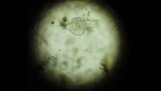 Rotifer 400x magnification OMAX MVI 3715