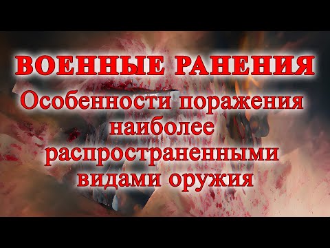 Военные ранения: особенности поражения наиболее распространенными видами оружия