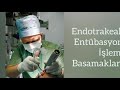 Endotrakeal Entübasyon(Airway,Endotrakeal Tüp,Laryngoskopi)/Okan Üniversitesi SHMYO Anestezi