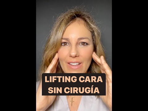 Video: ¿Los estiramientos faciales alguna vez se ven naturales?