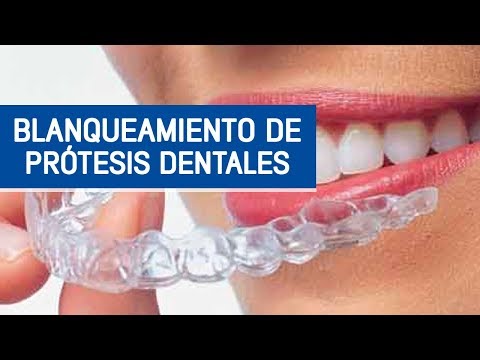 Cómo blanquear las prótesis dentales / Odontoespecialistas