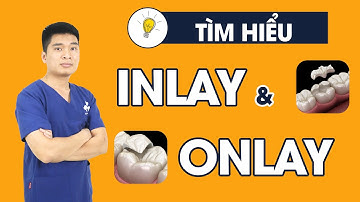 Phục hồi răng hàm sâu vỡ bằng inlay onlay | Nha Khoa Dr. Hưng