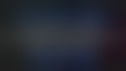 laparoscopy assisted PCNL for stone in unascended right pelvic kidney