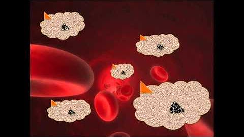 The clinical utility of Maintrac CTC testing - Dr. Joachim Fluhrer and Prof. Katharina Pachmann