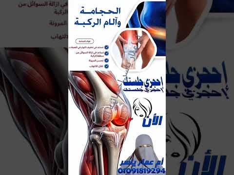 فوائد الحجامة لالم الركبة