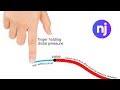 How to test a vein for valves  nursejanx